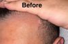 Need Advice on My Hair Regrowth – Baby Hairs Showing Up!