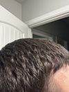 6 Months of 0.3 Fin 5% Min, Thinning More on One Side Now