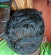 18, Experiencing Diffuse Thinning Since 8th Grade - Need Advice