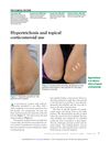 Hypertrichosis and Topical Corticosteroid Use