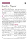Cicatricial Alopecia: Diagnosis and Treatment Overview