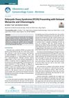Polycystic Ovary Syndrome (PCOS) Presenting with Delayed Menarche and Clitoromegaly