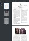 Reversible Hair Loss in a Patient With Cicatricial Alopecia: A Case of Regrowth Associated With Pioglitazone Use