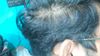 Advice needed regarding hair treatment