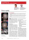 Tinea Capitis