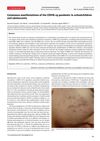 Cutaneous Manifestations of the COVID-19 Pandemic in Schoolchildren and Adolescents