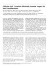 Follicular Unit Extraction: Minimally Invasive Surgery for Hair Transplantation