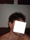30M Seeing Gradual Recession, Family History of Hair Loss, Considering Finasteride