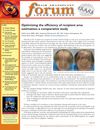Optimizing the Efficiency of Recipient Area Estimation: A Comparative Study