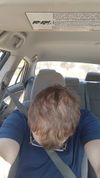 20M Concerned About Hair Progress After 2 Months on Finasteride and Minoxidil