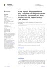 Case Report: Repigmentation and Complete Hair Regrowth in an 11-Year-Old Preadolescent with Alopecia Totalis Treated with a JAK Inhibitor