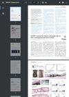 MCPIP1 Controls Effects of Myeloid Cells on Skin Carcinogenesis and Hair Growth