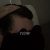Synchronized shed or finasteride losing effectiveness already?