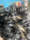 Hair fall at 17