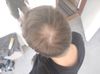 Hi I am a 24yo guy from EU is there some product I could use or is it over for me?