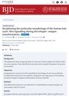 Deciphering the Molecular Morphology of the Human Hair Cycle: Wnt Signalling During the Telogen–Anagen Transformation