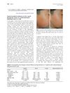 Topical Tacalcitol Ointment Can Be a Good Therapeutic Choice in Erythromelanosis Follicularis Faciei et Colli