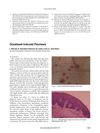 Docetaxel-Induced Psoriasis: A Case Report