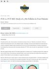 FUE vs. FUT-MD: Study of 1,780 Follicles in Four Patients