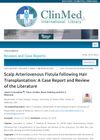 Scalp Arteriovenous Fistula Following Hair Transplantation: A Case Report and Review of the Literature