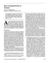 Hair Transplantation in Females