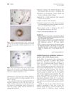Instilled Bimatoprost Ophthalmic Solution in Patients with Eyelash Alopecia Areata