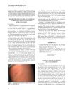 Fox Fordyce Disease in a Prepubertal Girl