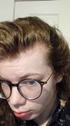 20, seeking advice on if i should be concerned with my current hairline