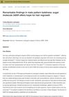 Remarkable Findings in Male Pattern Baldness: Sugar Molecule 2dDR Offers Hope for Hair Regrowth
