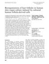 Reorganization of Hair Follicles in Human Skin Organ Culture Induced by Cultured Human Follicle-Derived Cells