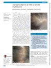 Androgenic Alopecia: An Entity to Consider in Adolescence