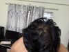 17 y/o Male Considering Finasteride + Minoxidil for Early Balding - Seeking Advice