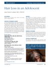 Hair Loss in an Adolescent: A Case Study of a 13-Year-Old Girl with Alopecia Areata