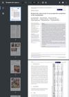 Recipient Site Scalp Necrosis: A Rare Postoperative Complication of Hair Transplantation