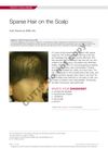 Sparse Hair on the Scalp in a 5-Year-Old Girl