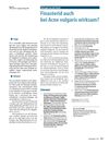 Is Finasteride Also Effective for Acne Vulgaris?
