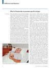 Effect of Finasteride on Prostate-Specific Antigen