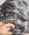 Is this normal? (losing hair on side of head)