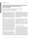 A Prospective Study of the Prevalence of Polycystic Ovary Syndrome in Unselected Caucasian Women from Spain