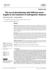 The Use of Phototherapy With Different Wavelengths in the Treatment of Androgenetic Alopecia