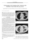 Trichomegaly of the Eyelashes After Treatment with Erlotinib in Non-Small Cell Lung Cancer