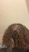 19M with 6 Months Diffuse Thinning, Using Ketoconazole for 3 Months, Considering Finasteride