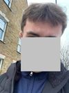 Advice on 0.5mg Dutasteride + 2.5mg Minoxidil for Hair Loss Reversal