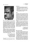 Bald Scalps and Wrinkles: Concerns About Minoxidil and Tretinoin Treatments