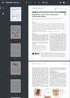 Regulatory T Cells in Skin Regeneration and Wound Healing