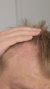 Needing some advice on what medicine to take after my dermatologist appointment