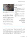 Trichorrhexis Nodosa After Hair Transplantation: Dermoscopic, Pathologic and Electron Microscopy Analyses
