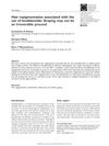 Hair Repigmentation Associated with the Use of Lenalidomide: Graying May Not Be an Irreversible Process