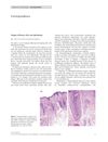 Telogen Effluvium After Oral Albendazole