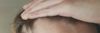 Is my hairline starting to minituarize?